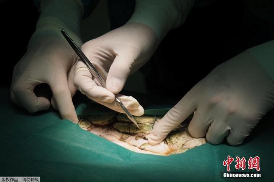 海龜誤食許愿池硬幣 醫(yī)生為其手術(shù)取出915枚(圖)