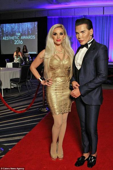 男子花300萬整容51次 破吉尼斯紀(jì)錄