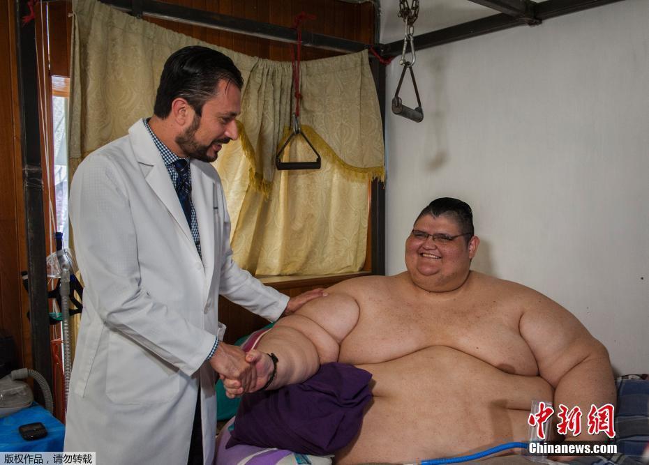 墨西哥男子體重曾達半噸 網(wǎng)友：有點像米其林(圖)